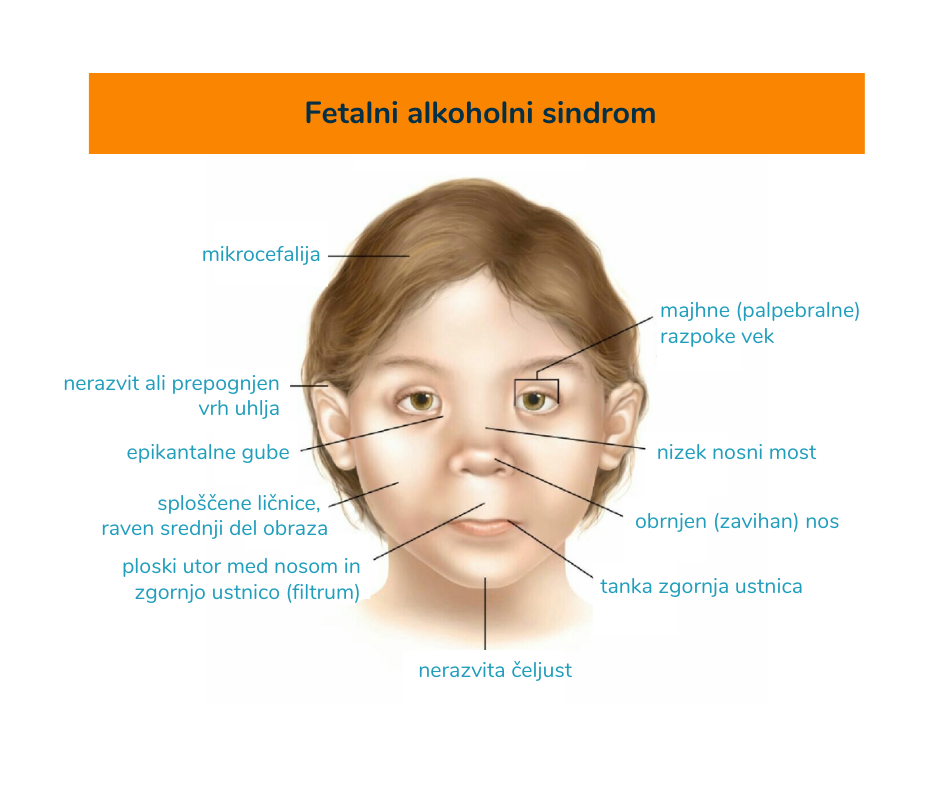 Ta slika ima prazen atribut alt; ime datoteke je Izdelek-brez-naslova.png